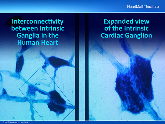 Little Brain in the Heart-Neuron-slide-1
