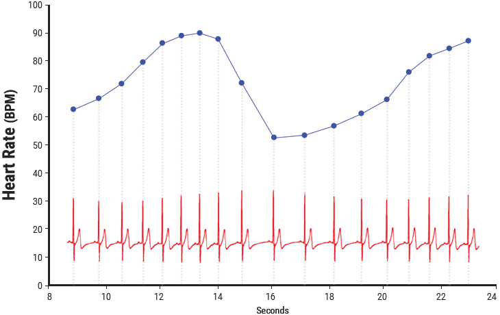 Heart Rate Variability Chart