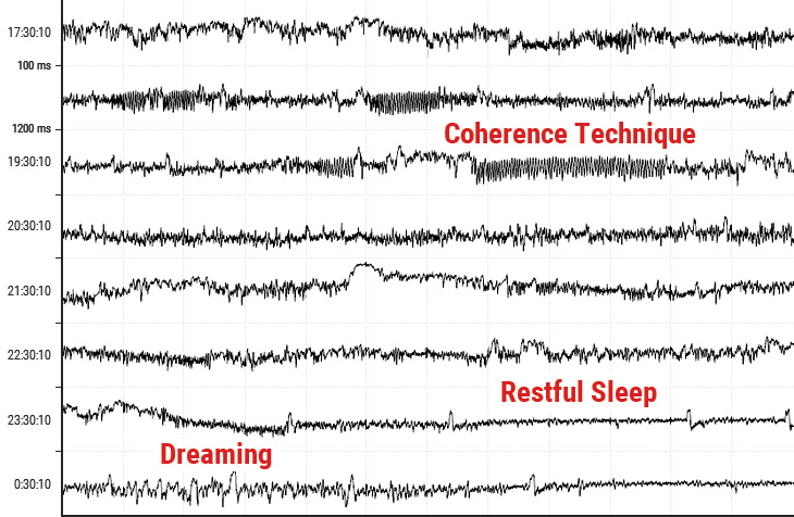 Heart Rate Tachogram