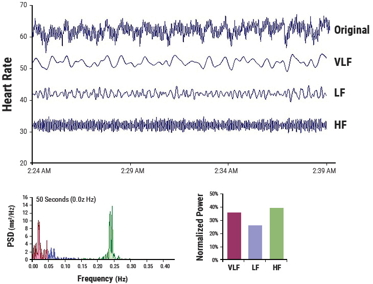 Heart Rate Variability Chart