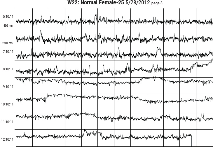 HeartMath Autonomic Assessment Report