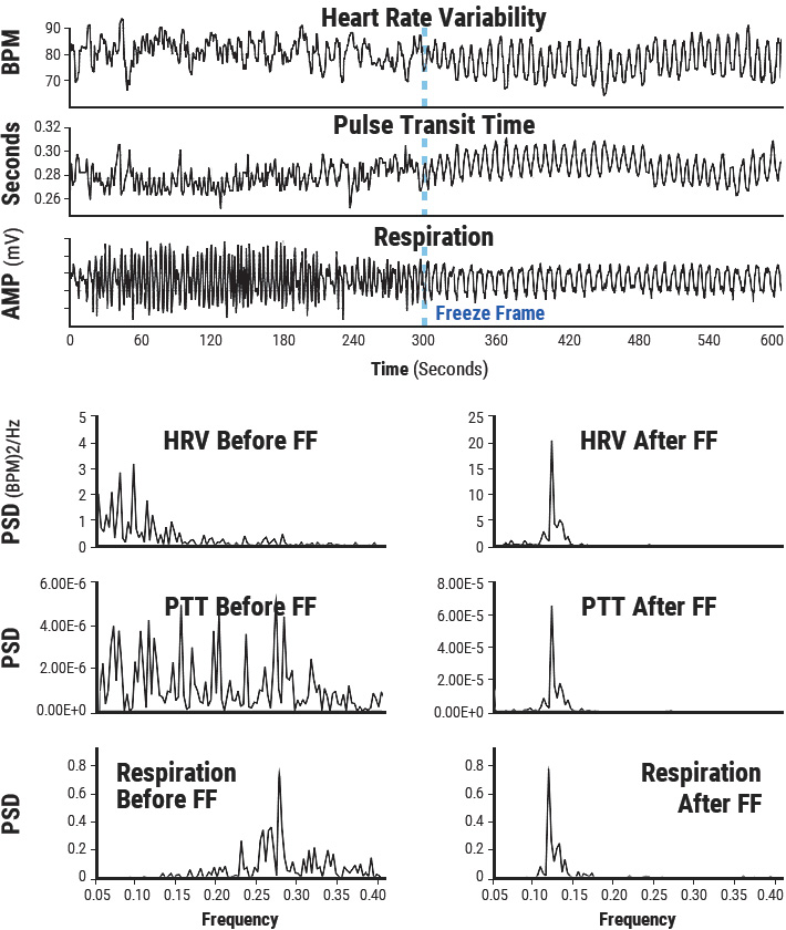 Heart Rate Variability