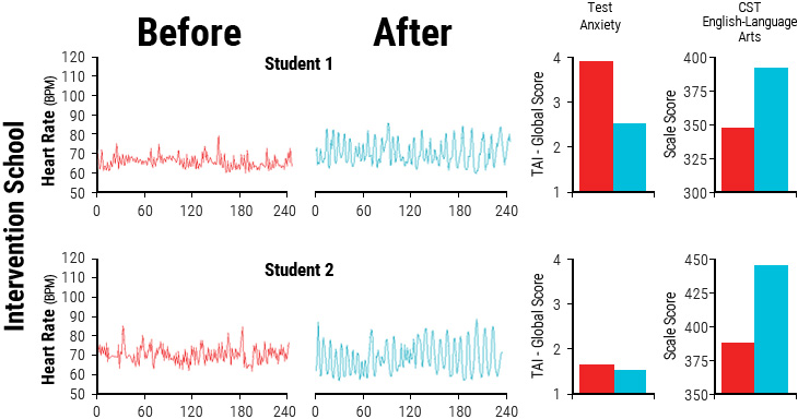 Typical resting state heart rate variability patterns in students