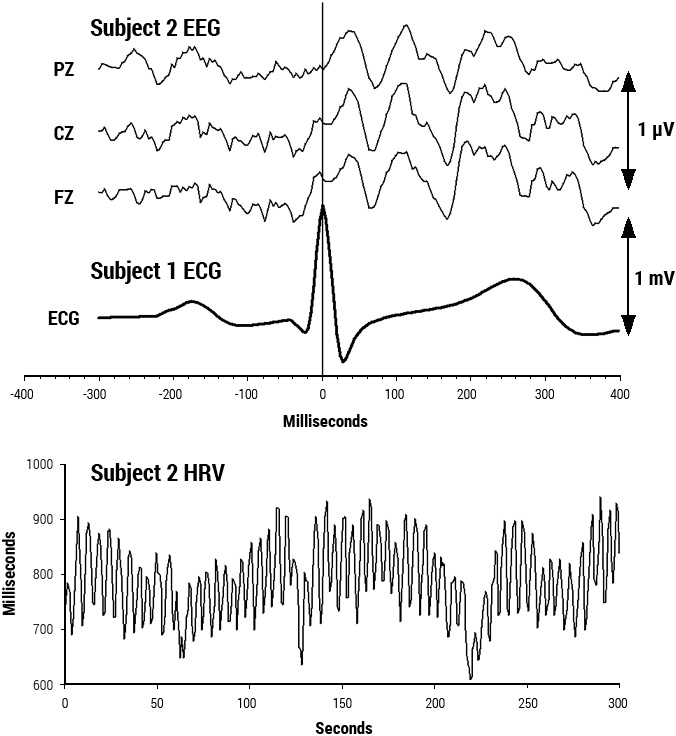 Heart-Brain Synchronization