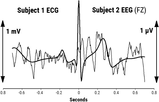 Overlay of signal-averaged EEG and ECG