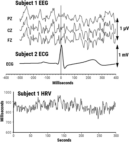 Overlay of signal-averaged EEG and ECG