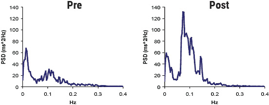 Group mean HRV power spectra