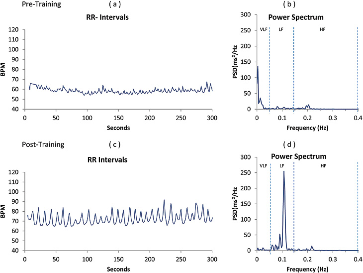 Effects of Heart Rhythm Coherence Training