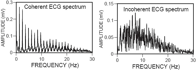 Coherent and incoherent ECG spectra Coherent and incoherent ECG spectra