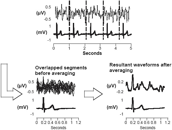 The Signal Averaging Technique The Signal Averaging Technique