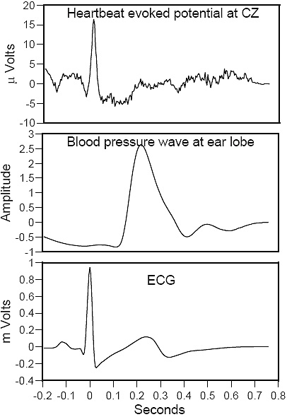 Heartbeat Evoked Potential