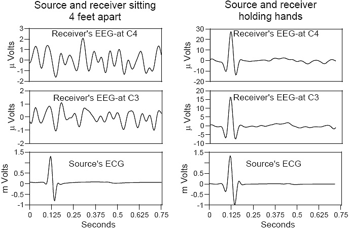 Cardiac signal averaged waveforms before and while holding hands