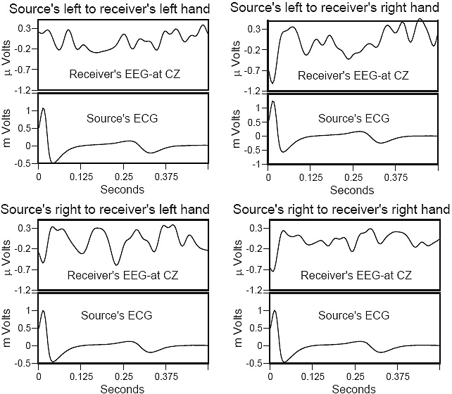 Cardiac signal averaged waveforms with different hand holding orientations