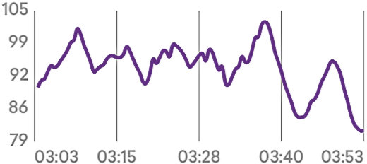 Heart Rate Variability (HRV)