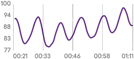 Heart Rate Variability (HRV)