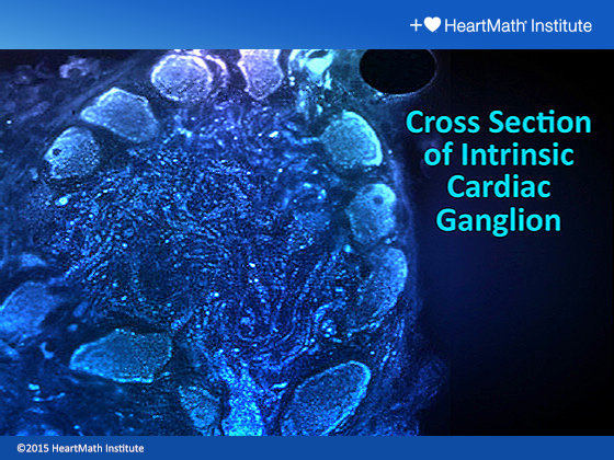 Cross Section of Intrinsic Cardiac Ganglion